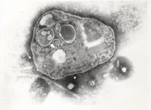 Rinderpest Virus (RPV)