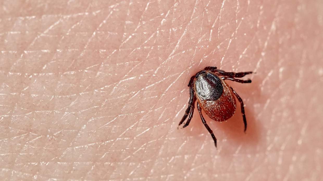 Tick-borne troubles: Exploring Lyme illness Tick-borne troubles: Exploring Lyme illness