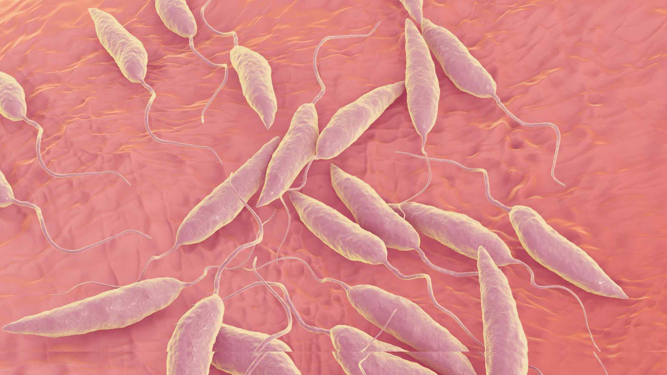 Causes, Signs, Remedy, and extra Causes, Signs, Remedy, and extra