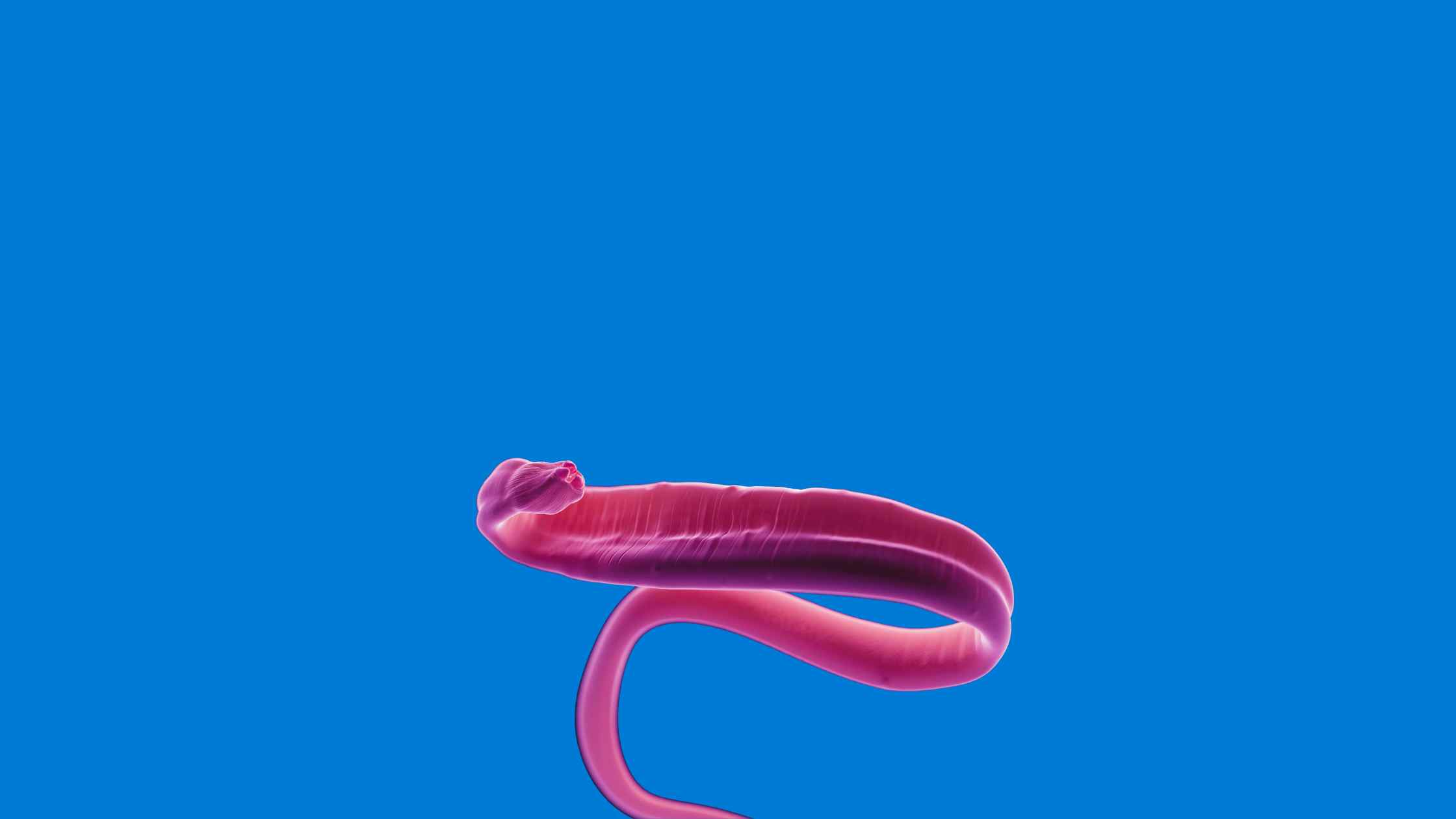 3 parasite infections you will get out of your pets 3 parasite infections you will get out of your pets