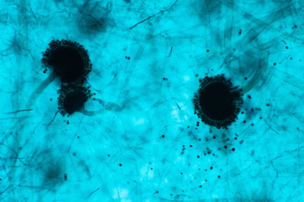 Aspergillus (mold) under the microscopic view. Aspergillus is an agent of fungal infection.