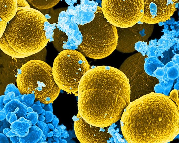 Staphylococcus aureus, 20,000X magnification