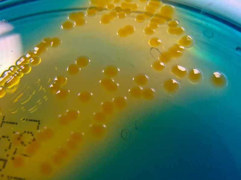 Vibrio cholerae bacteria on agar